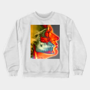 Orthodontic brace X-ray (M780/0342) Crewneck Sweatshirt